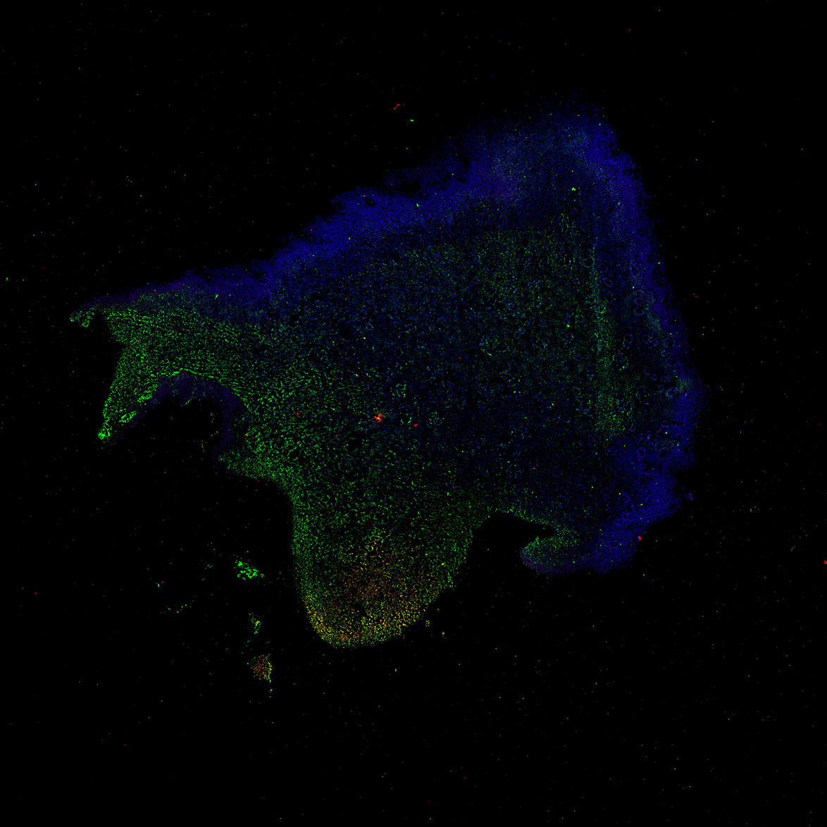 Human foetal midbrain